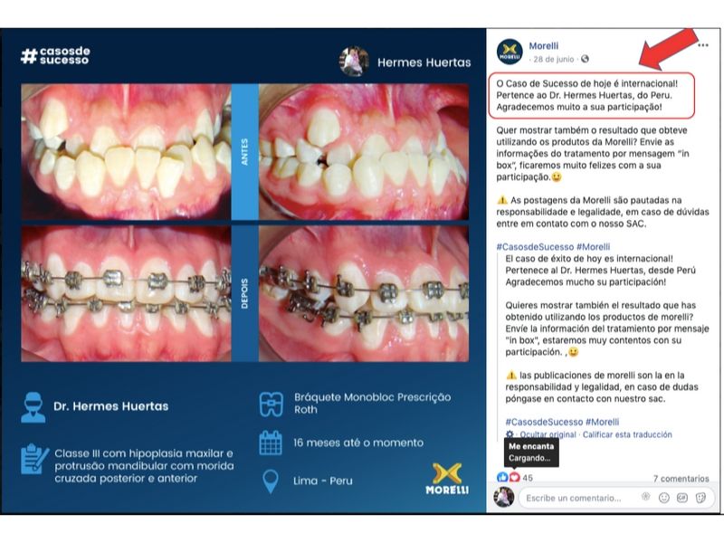 ¿Cuánto cuesta ponerse brackets?